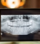 טכנולוגיות מתקדמות לטובת רפואת השיניים-תמונה